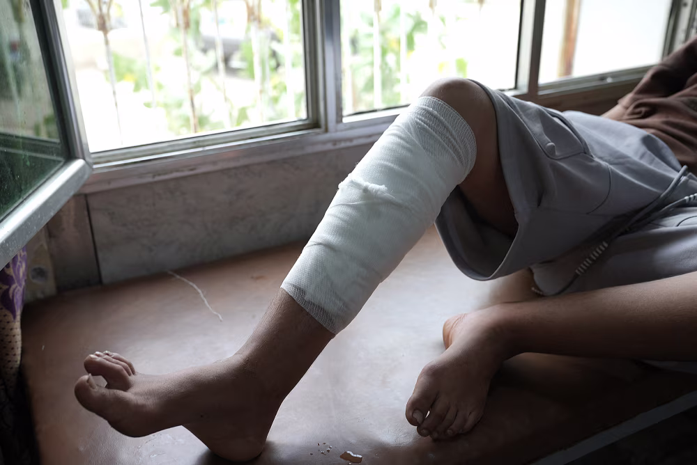 A guerra civil do Iêmen retorna e sobrecarrega os hospitais com 'uma situação muito perigosa'