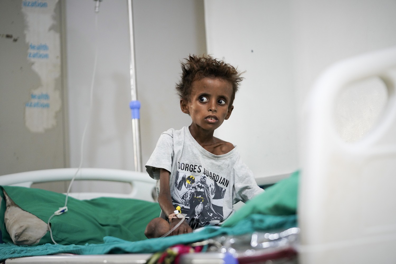 Tarek al-Salami, 7, who was displaced from the city of Mokha and is showing symptoms of malnutrition, sits on a bed while receiving treatment at a therapeutic feeding center in Buraiqa, on the western outskirts of Aden, Yemen, Tuesday, Sept. 22, 2026.