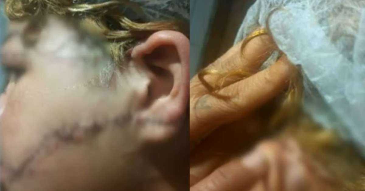 Homem que esfaqueou a ex no rosto e na orelha é preso por tentativa de feminicídio em GO