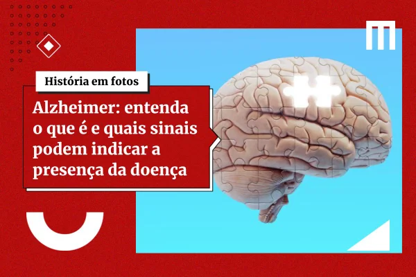 Alterações do Alzheimer podem surgir antes de falhas na memória, diz estudo