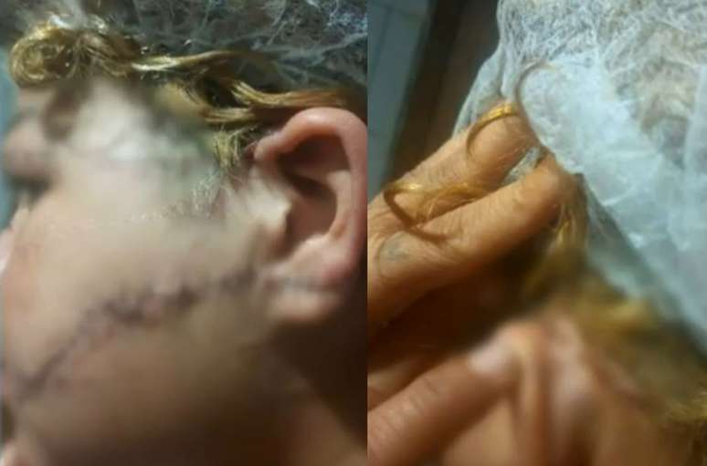Homem que esfaqueou a ex no rosto e na orelha é preso por tentativa de feminicídio em GO