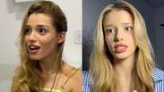 Jovem que viralizou ao se escutar pela 1&ordf; vez diz que implante mudou sua vida: &lsquo;Cada dia &eacute; melhor&rsquo;