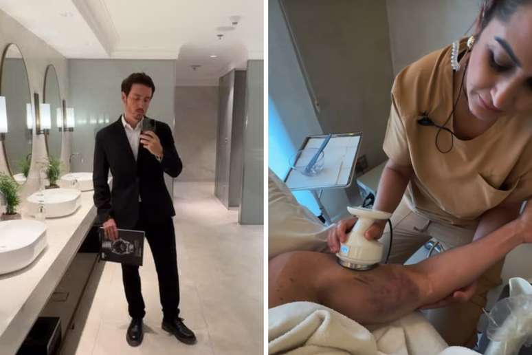 Ator da Globo Wagner Santisteban mostra hematomas após acidente na academia: 'Doendo muito'
