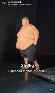 Noiva atualiza estado de saúde do Gordão da XJ após internação: “Dor”