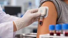 Transplante inédito na Itália devolve parte da visão a mulher após cinco anos de cegueira